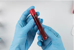 Hands wearing medical gloves holding a blood sample in a laboratory test tube, highlighting clinical diagnostics, blood testing, health checkups, and laboratory services.