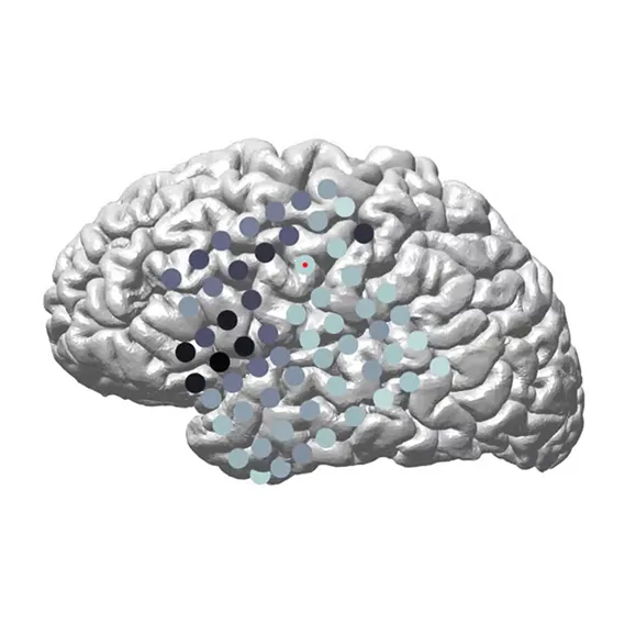 3D brain model with colored dots highlighting key data points